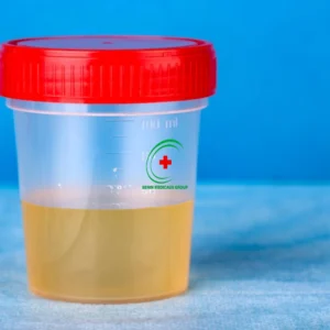 Pot d'urine