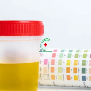 Test d'urine à 10 paramètre