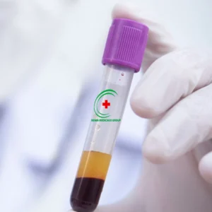 Tube CITRATE en plastique